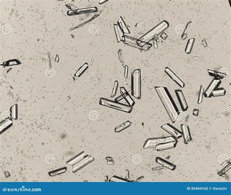 Amorphous Crystals In Human Urine at Carole Spears blog