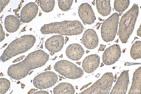 PLK4 antibody (12952-1-AP) | Proteintech
