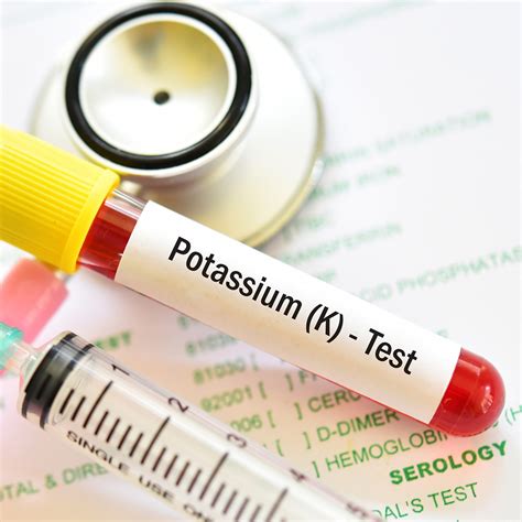 Image result for How to Check Potassium Levels
