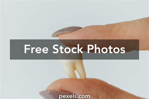 Image result for Tooth Extraction HD Images