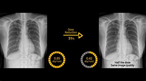 Latest Equipment - CT scan, Sonography, Digital X-ray and More