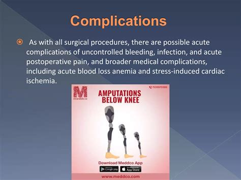 Amputations below knee | PPTX
