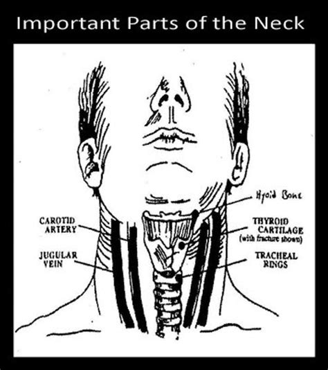 Image result for Postural Strangulation
