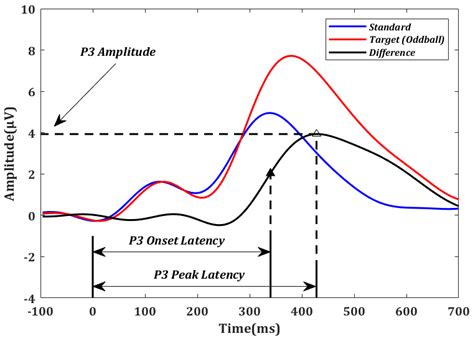 Global Functional Connectivity at Rest Is Associated with Attention: An ...