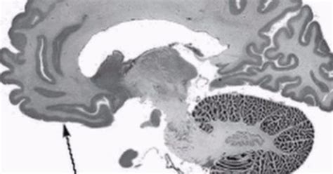 Contact Split Brain Behavioral Experiments 的图像结果