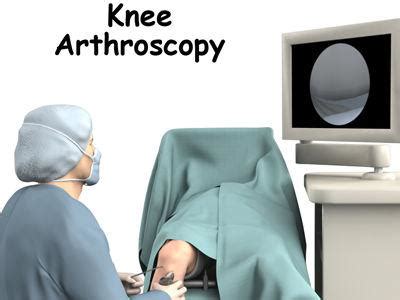 膝关节镜手术相对安全 并发症发生率低 | 领医迈