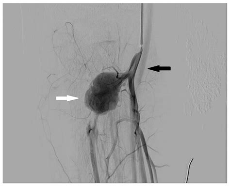 Digital Subtraction Angiography (DSA) Technical and Diagnostic Aspects in the Study of Lower ...