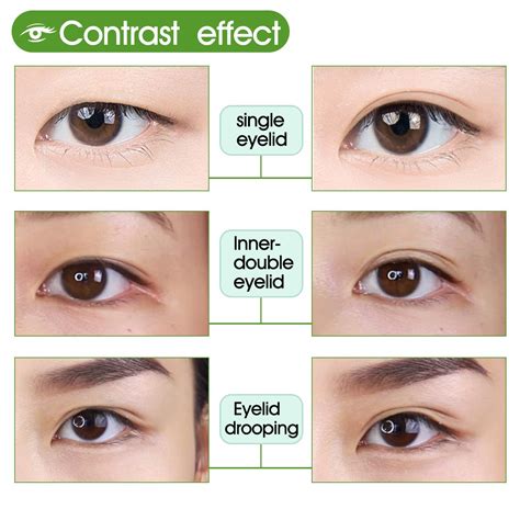 Double Eyelids Definition | Monolids Vs Double Eyelids – XNCUC