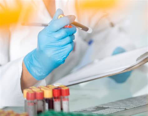 Bilirubin blood test