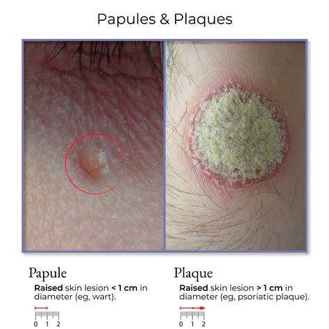 Clinical Medicine: Dermatology Exam | ditki medical & biological sciences