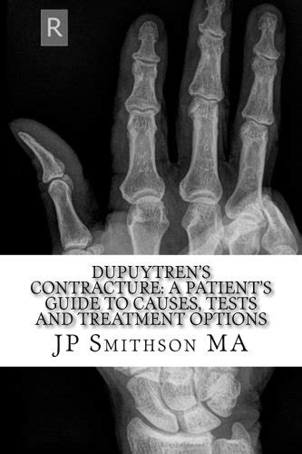 Dupuytrens Contracture A Patients Guide To Causes Tests And Treatment ...