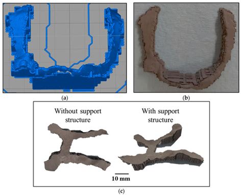 Investigation of Patient-Specific Maxillofacial Implant Prototype ...
