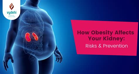 How Obesity Affects Your Kidney: Risks & Prevention | VIMS&RC