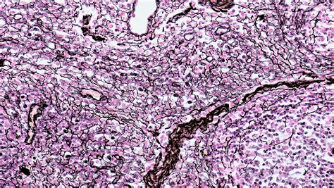 Connective Tissue: Histology | Concise Medical Knowledge