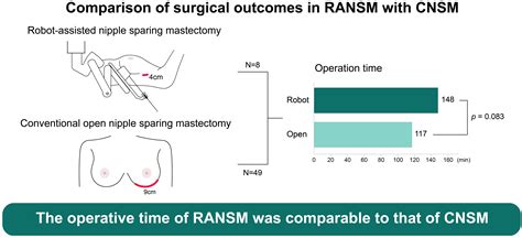 Nipple Sparing Mastectomy