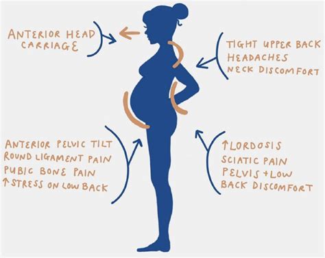 Back And Body Pain During Pregnancy at Theodora Alvarado blog