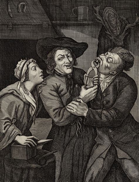 Image result for Medieval Tooth Extraction