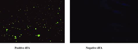 Image result for DFA Injective