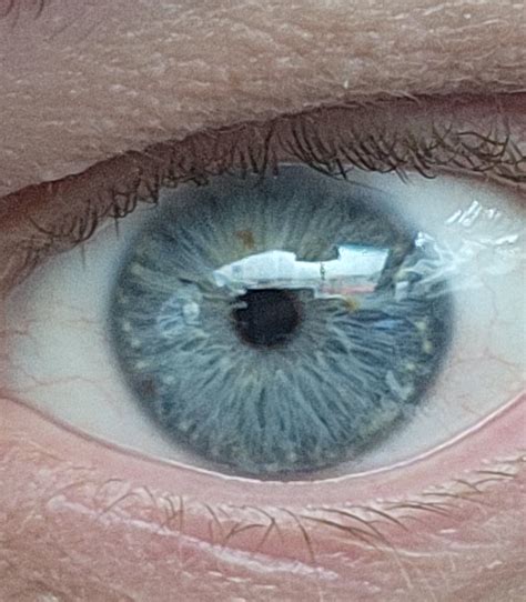 Old eye doc says blue, new one says gray because of the brown specks and no variation to the ...