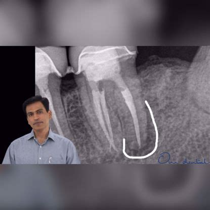 Short videos: The OD Clinical Skills Program-One Dental is the Biggest ...