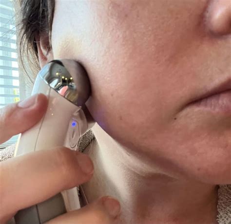 NuFace Neck Tutorial 的图像结果