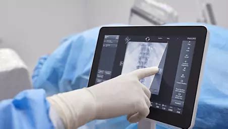 Philips - Zenition 30 - Mobile C-arm with Flat Detector