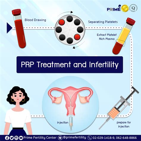 Blood Platelet Treatment and Infertility | Thailand IVF/ICSI/IUI