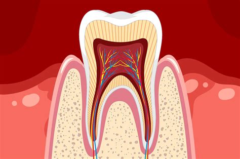 Acid Reflux (GERD) and its Hidden Impact on Teeth – Colgate Professional