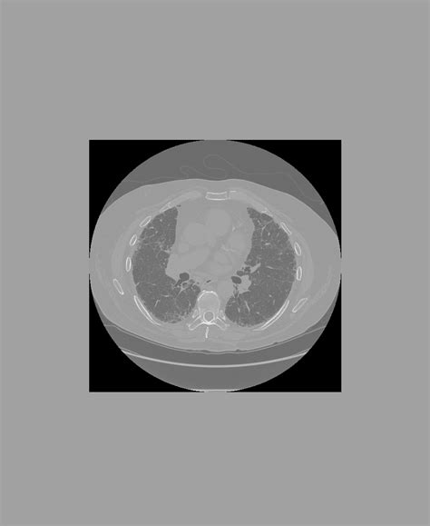 Image result for Python-Opencv Padding