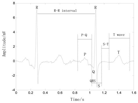 A Human ECG Identification System Based on Ensemble Empirical Mode ...