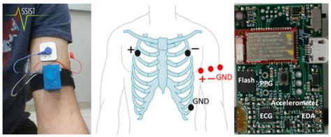 A Pipeline for Adaptive Filtering and Transformation of Noisy Left-Arm ...