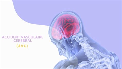 Image result for AVC Video Explicative