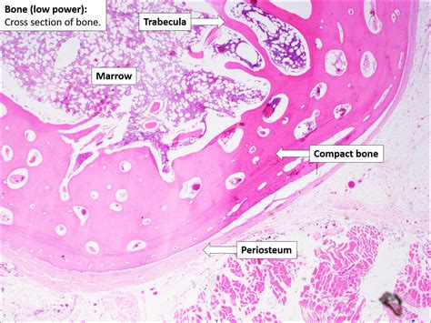 Bone – Normal Histology – NUS Pathweb :: NUS Pathweb