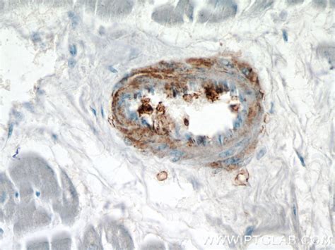transgelin/SM22 antibody (60213-1-Ig) | Proteintech