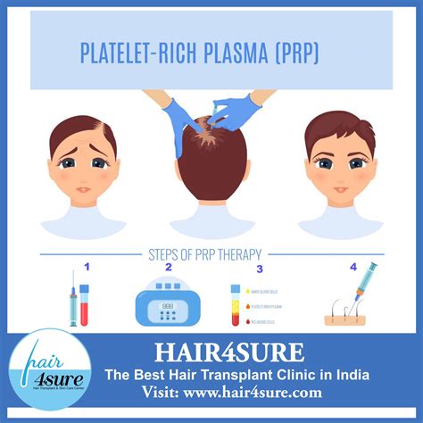 Platelet rich plasma hair treatment prp – get the facts – Artofit