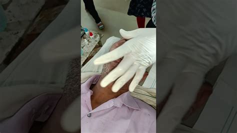 Subconjunctival Injection 的图像结果