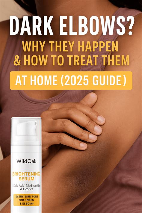 Best Dark Elbow Treatment in India (2025) | WildOak Pigmentation Serum ...
