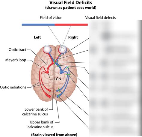Image result for Visual Deficit Chart