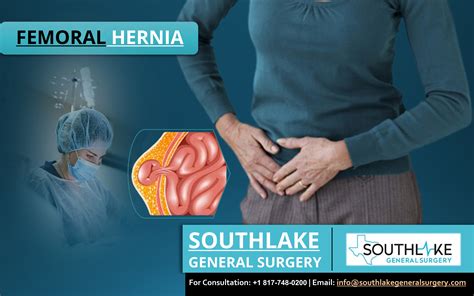 Symptoms Of A Femoral Hernia In Women | Detroit Chinatown