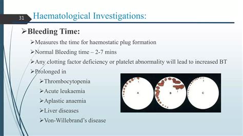 Routine laboratory investigations | PPTX