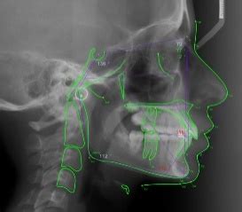 RVS DENTAL COLLEGE AND HOSPITAL | Best Dental Colleges in coimbatore