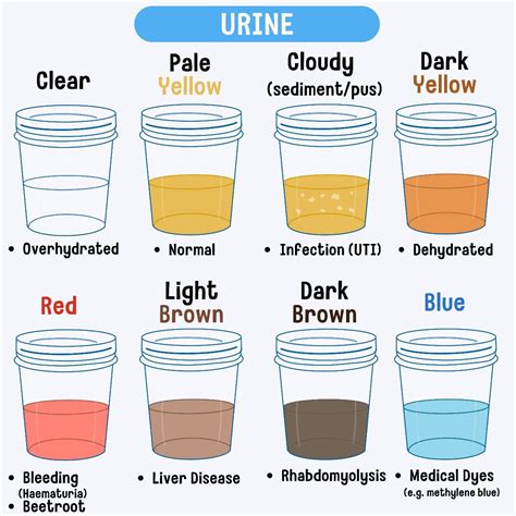Straw Colored Urine