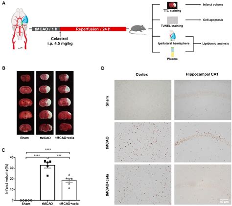 Lipidomic Profiling of Ipsilateral Brain and Plasma after Celastrol ...