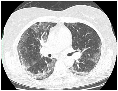 Safe, Smart, and Scalable: A Prospective Multicenter Study on Low-Dose ...