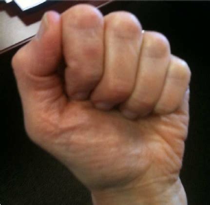 Image result for Genetics in Hand Shape