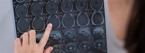 Image result for Scanner Cerebral Avec Injection Diode