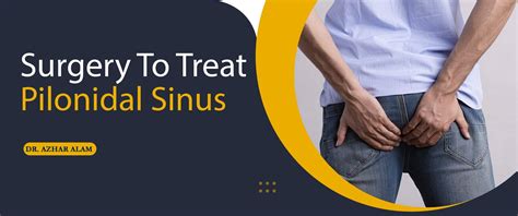 Topical Ointment For Pilonidal Cyst at Hayden Champ blog