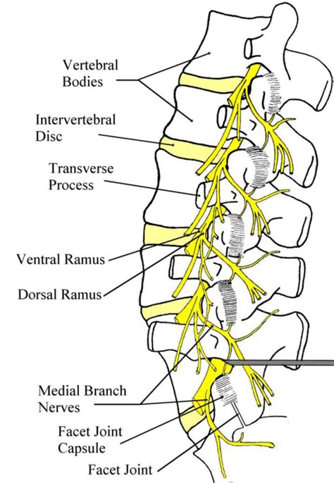 Image result for Selective Nerve Root Block