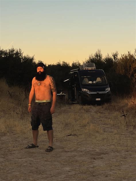 Can see scalp only when hair is wet, is it normal? : r/bald