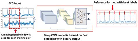 Applications of Machine Learning in Ambulatory ECG